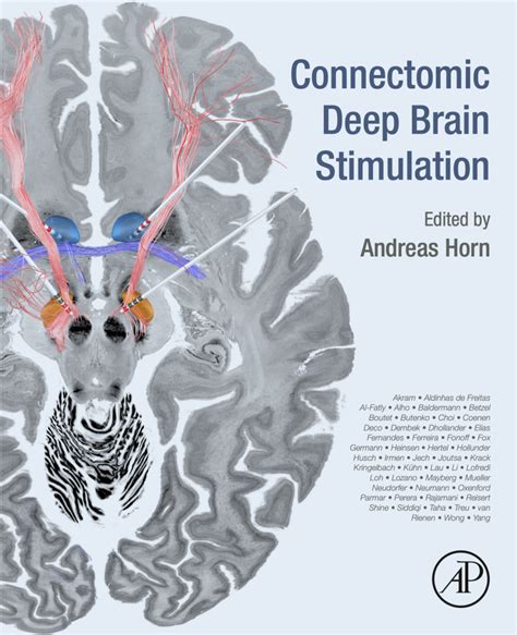 Connectomic Deep Brain Stimulation Book Available Now Network