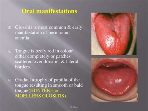 Hematological And Systemic Disorders 1