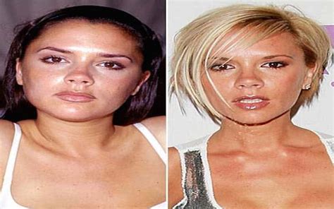 Worst Cases Of Celebrity Plastic Surgery Gone Wrong