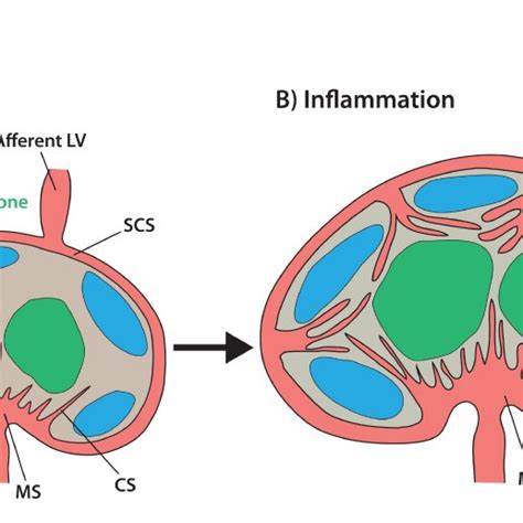 (PDF) Lymphatic Vessels in Inflammation