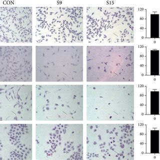 Ssd Inhibited The Proliferation Of Gbm Cells And Gbm Cell Morphology