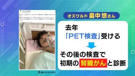 “沈黙の臓器”にも有効がん早期発見で成果『pet Ct検査』のメリットと課題 医師「がんを死なない病気に」 東海テレビnews