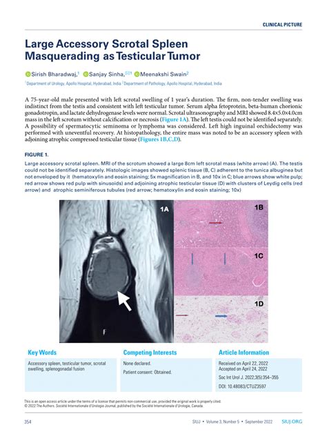 Pdf Large Accessory Scrotal Spleen Masquerading As Testicular Tumor