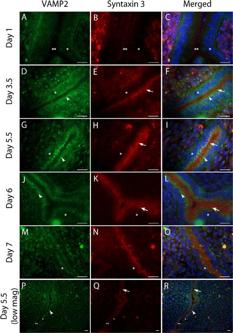 Vamp And Syntaxin Localisation In Rat Uterine Epithelial Cells Uec