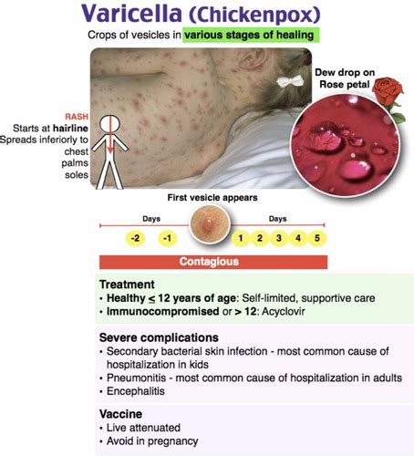 Varicella Infection Flashcards Quizlet