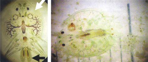 parasit  infeksi sekunder