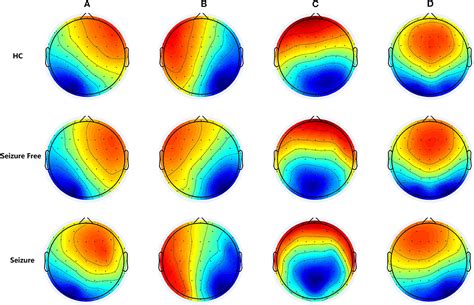 Frontiers Altered Resting State Electroencephalography Microstates In