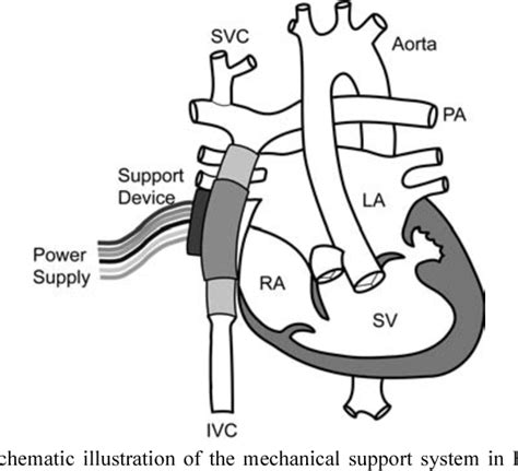 Figure From Structural Design Of A Newly Developed Pediatric