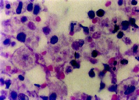 Entamoeba Histolytica Structure