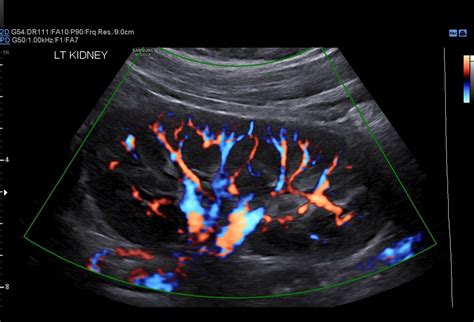 Renal Scan Womens Imaging