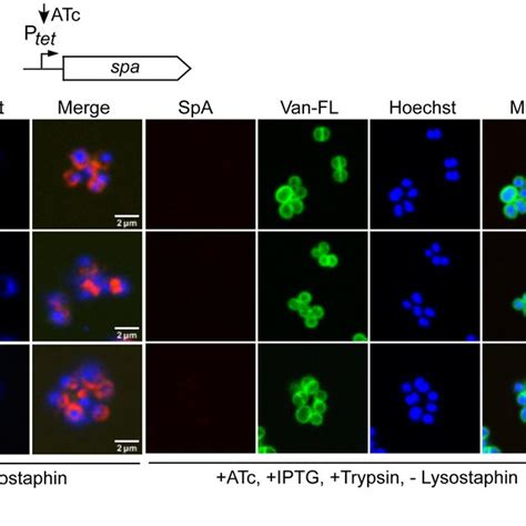 Cell Cycle‐dependent Lta Localization In S Aureus A Lta Subcellular Download Scientific