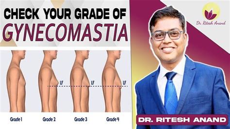 Pin on Gynecomastia Surgery(Male breast)