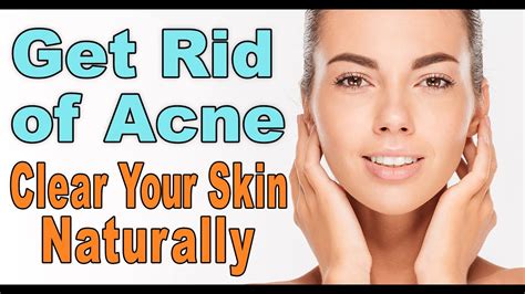 Get Rid Of Acne Clear Your Skin Naturally Say Goodbye To Acne And