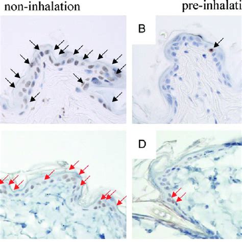 TUNEL And 8 OHdG Staining Of Skin Sections 24 H After 20 Gy