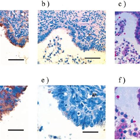 Immunohistochemical Staining Of Slpi Producing Cells In The Fallopian