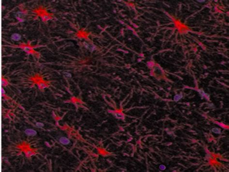 [figure Astrocytes Image Courtesy O Chaigasame] Statpearls Ncbi