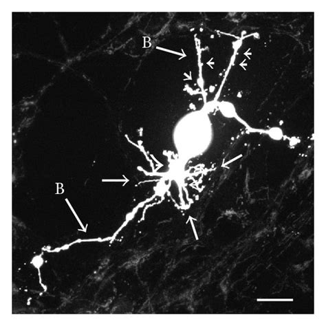 (a and b) show formation of filopodia and spine-like processes ...