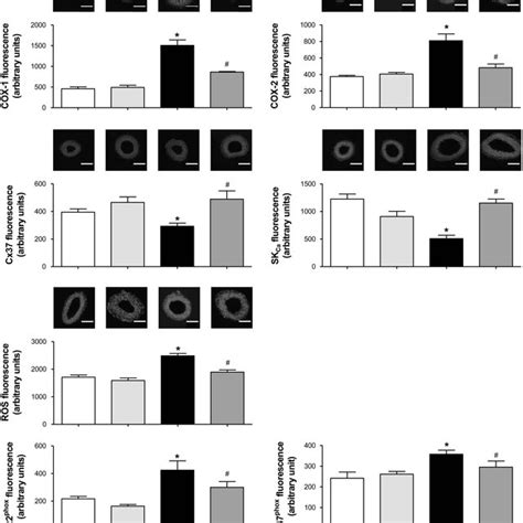 Epadha 61 Prevents The Ang Ii Induced Vascular Oxidative Stress And