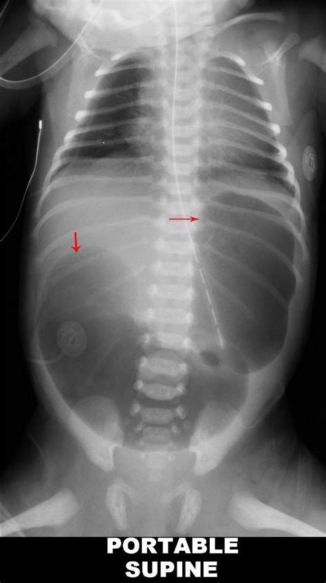 Gastrointestinal Radiology