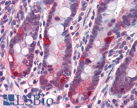 Ihc Plus Nod Card Polyclonal Antibody Rabbit Anti Human Lsbio