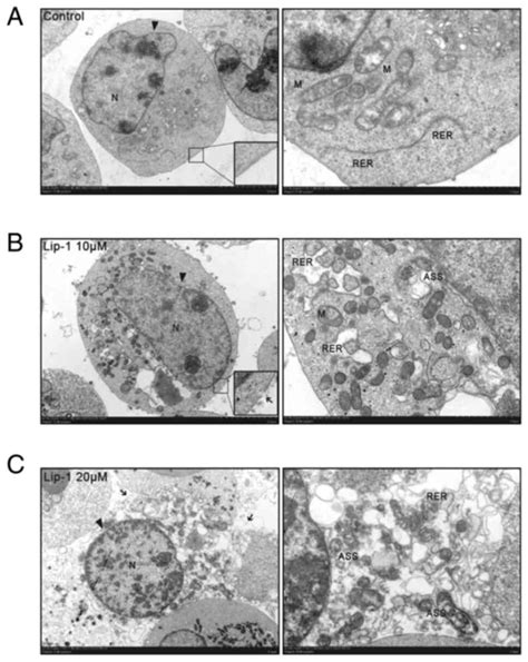 Liproxstatin Induces Cell Cycle Arrest Apoptosis And Caspase