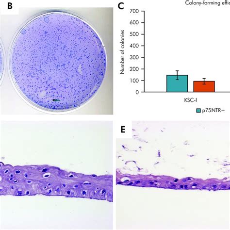 Colony Forming Efficiency And In Vitro Epithelial Reconstruction A