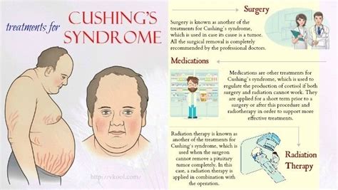 Top 4 Alternative Treatments For Cushings Syndrome In Humans Générale