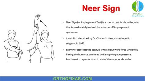 Neer Test Neer Test (or Neer Impingement Test) is a special test for ...