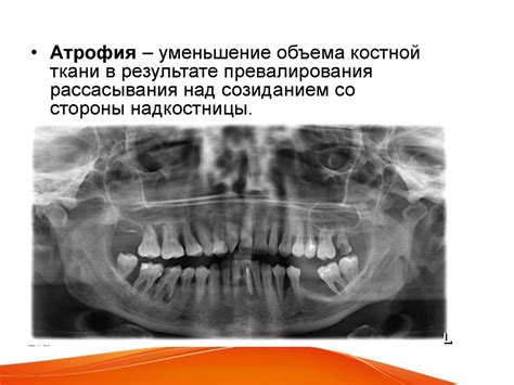 Лучевая диагностика в стоматологии - презентация онлайн