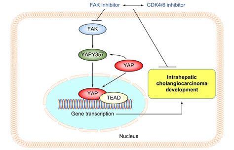 Focal Adhesion Kinase Fak Promotes Cholangiocarcinoma Development And