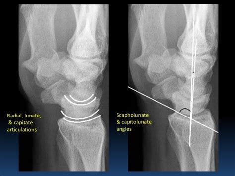 Radiographic Msk Anatomy