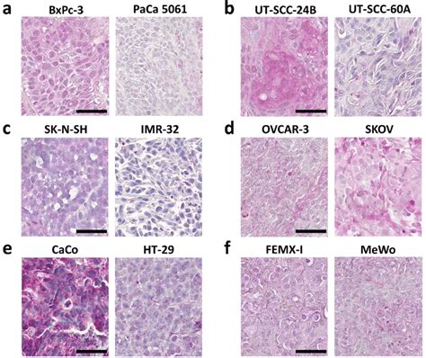 Representative Ykl 40 Immunostaining Results In Mouse Xenograft Tumors Download Scientific