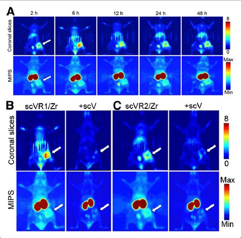 PET Imaging With VEGFR Specific Targeted Tracers Tumorbearing Mice