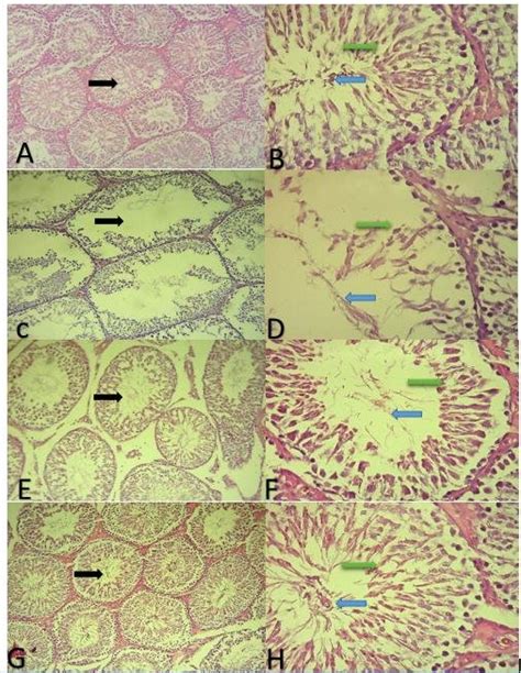 Cross Section Of Testicular Rats Tissue Under Hande Stain Black Arrow