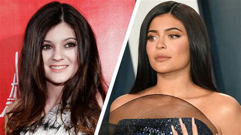 Kylie Jenner Before And After Her Jaw Dropping Transformation Pics