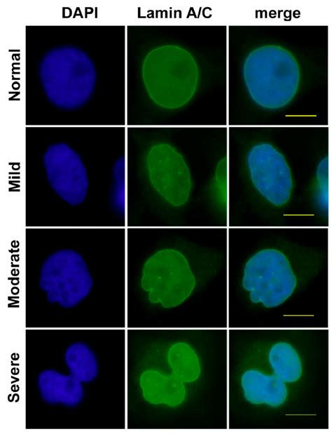 Four Categories Of Nuclear Morphology Nuclear Shape Of Rnai Treated