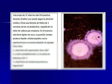 Solution Patolog A Infecciosa Bacterias Micoticas Studypool