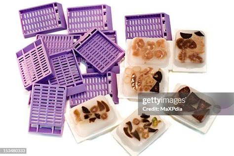 pathology block stock  high res pictures  images