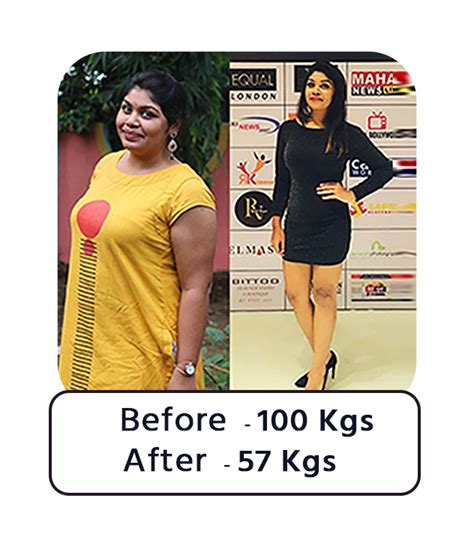 Bariatric Surgery - Before & After (Success Story) - Dr. Manish Motwani