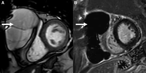 Cardiac Magnetic Resonance Imaging Techniques And Applications For