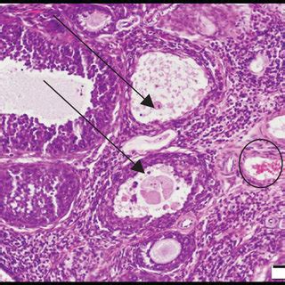 Photomicrographs Of Ovarian Sections Stained With Hematoxylin And