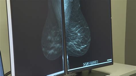 Artificial Intelligence In Breast Cancer Screening Wusa9