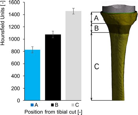 Cortical Bone Data Measured In Hounsfield Units Hu In Download Scientific Diagram