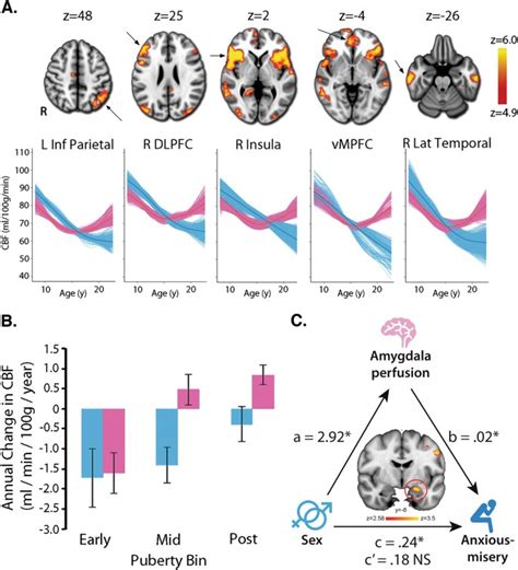 Sex Differences In The Developing Brain Insights From Multimodal Neuroimaging