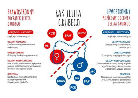 Przerzutowy Rak Jelita Grubego Leczony Coraz Skuteczniej Zwrotnikraka Pl