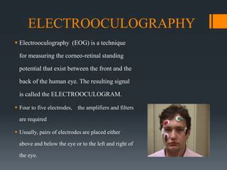 ELECTROOCULOGRAPY | PPT