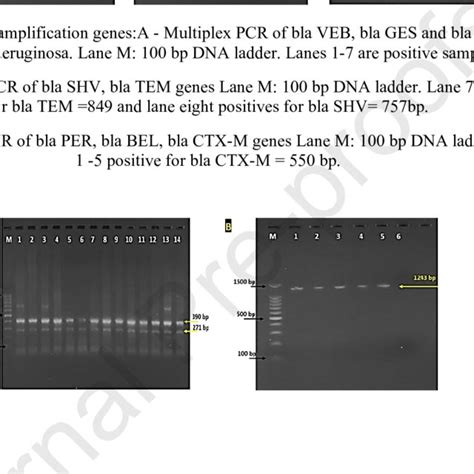 Kirby Bauer Disc Diffusion Method For Antibiotic Susceptibility Test Of Download Scientific