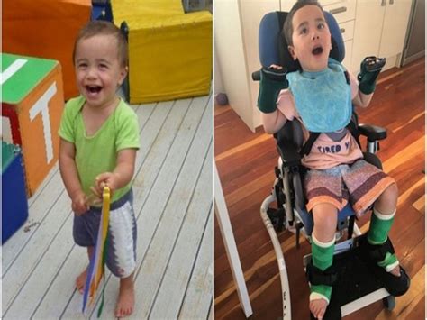 Garoto fica paraplégico após engasgar pedaço de maçã e caso serve