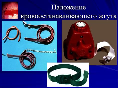 Неотложная помощь при несчастных случаях - презентация онлайн