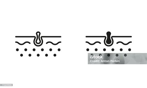 Blackhead Line And Silhouette Black Icon Set Pimple And Inflammation